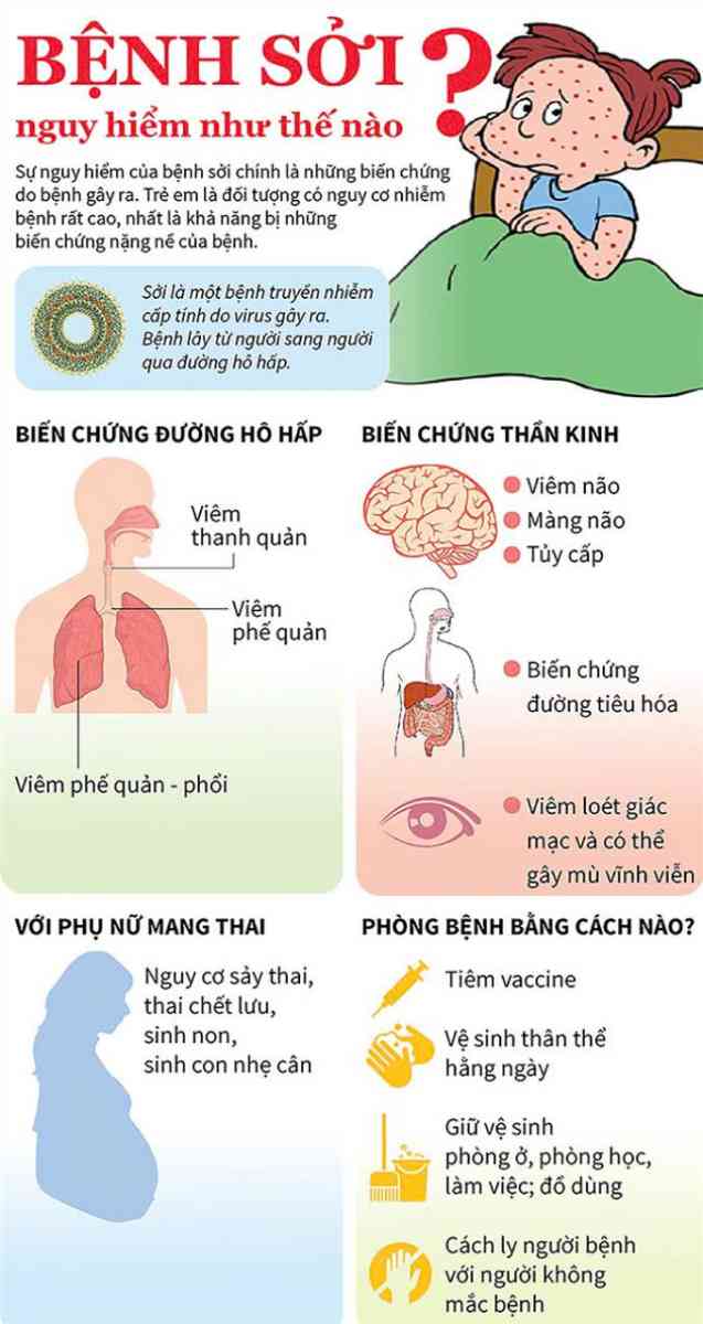 bệnh sởi